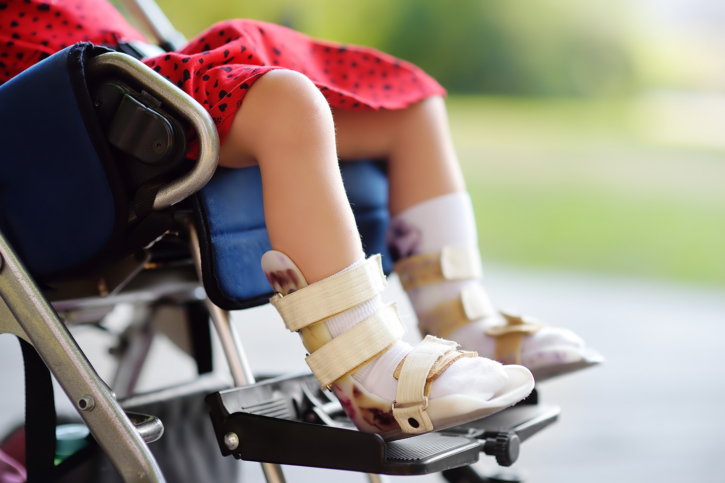 Child sitting in wheelchair wearing AFOs.