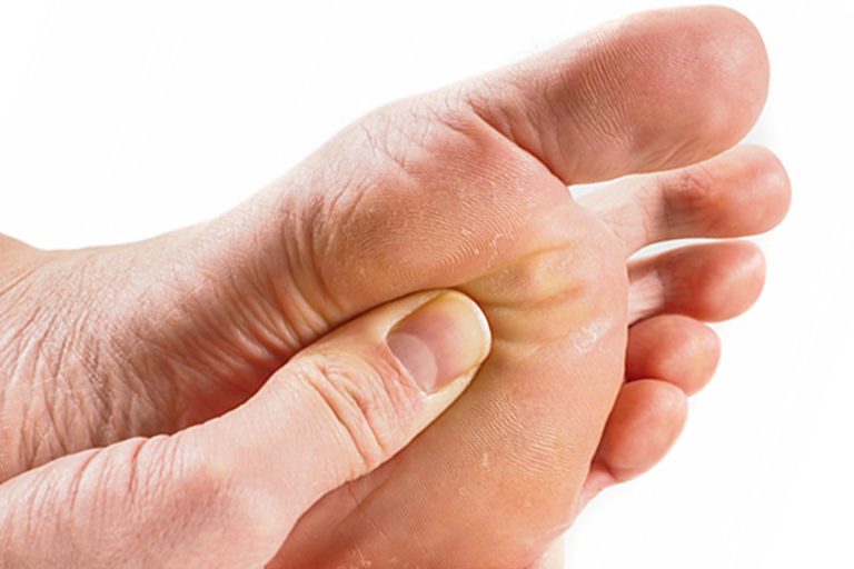 Metatarsalgia | Orthotics Plus Melbourne