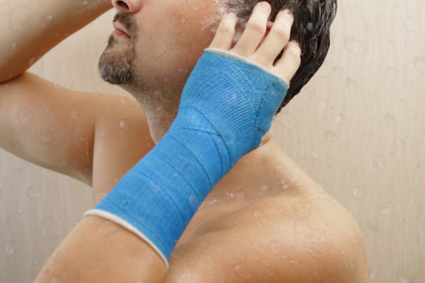 Waterproof Casts and Cast Covers for Bathing or Swimming