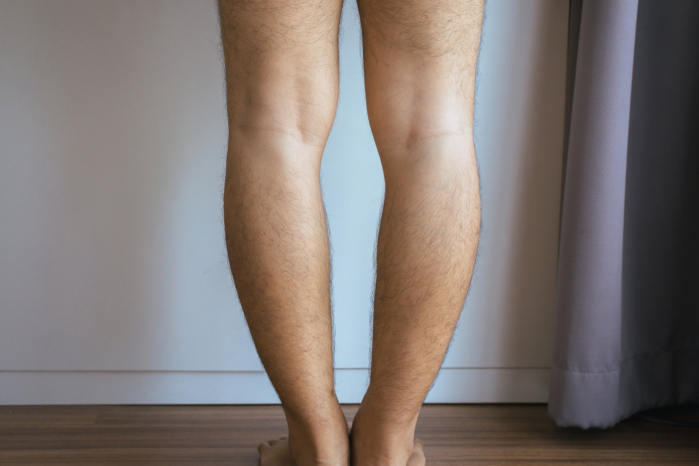 bow-legged-assessments-orthotics-plus-melbourne