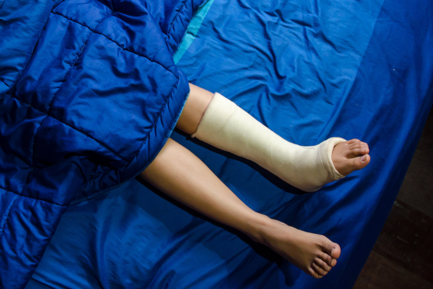 Asian girl is sleeping on blue bed in bedroom.Ankle strap for treating torn wound of foot injury. On the blue floor.Foot and ankle strap protects against injury.Do not focus on objects.