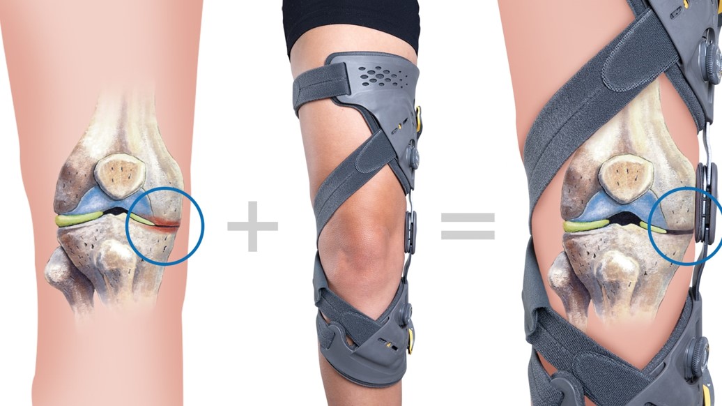 Unloader Knee Brace, Osteoarthritis Support