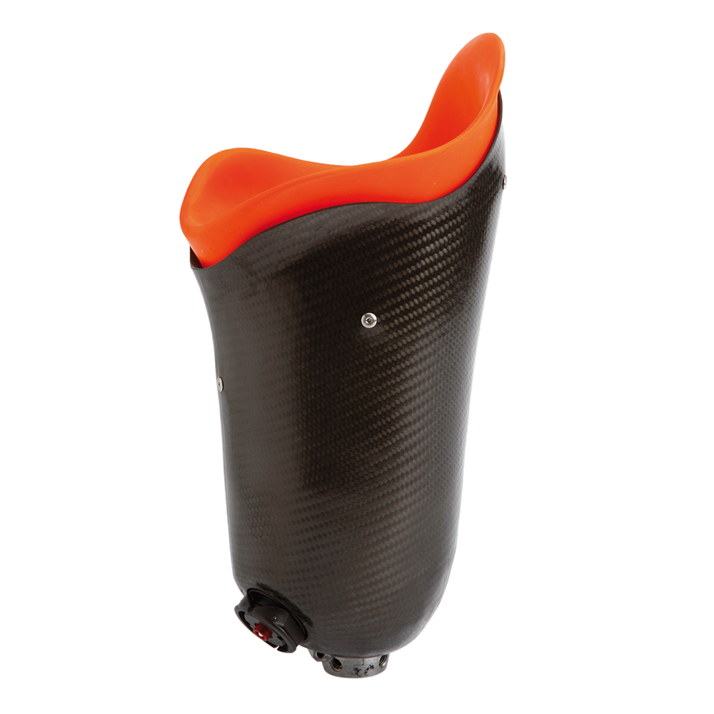 Above knee prosthetic socket